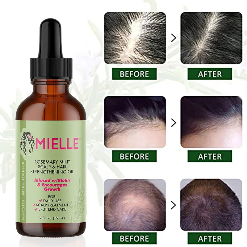Huile essentielle de romarin pour la croissance des cheveux