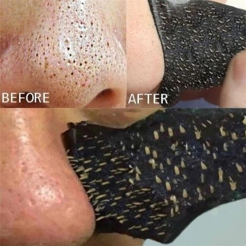 25 bandes anti-points noirs pour le nez.