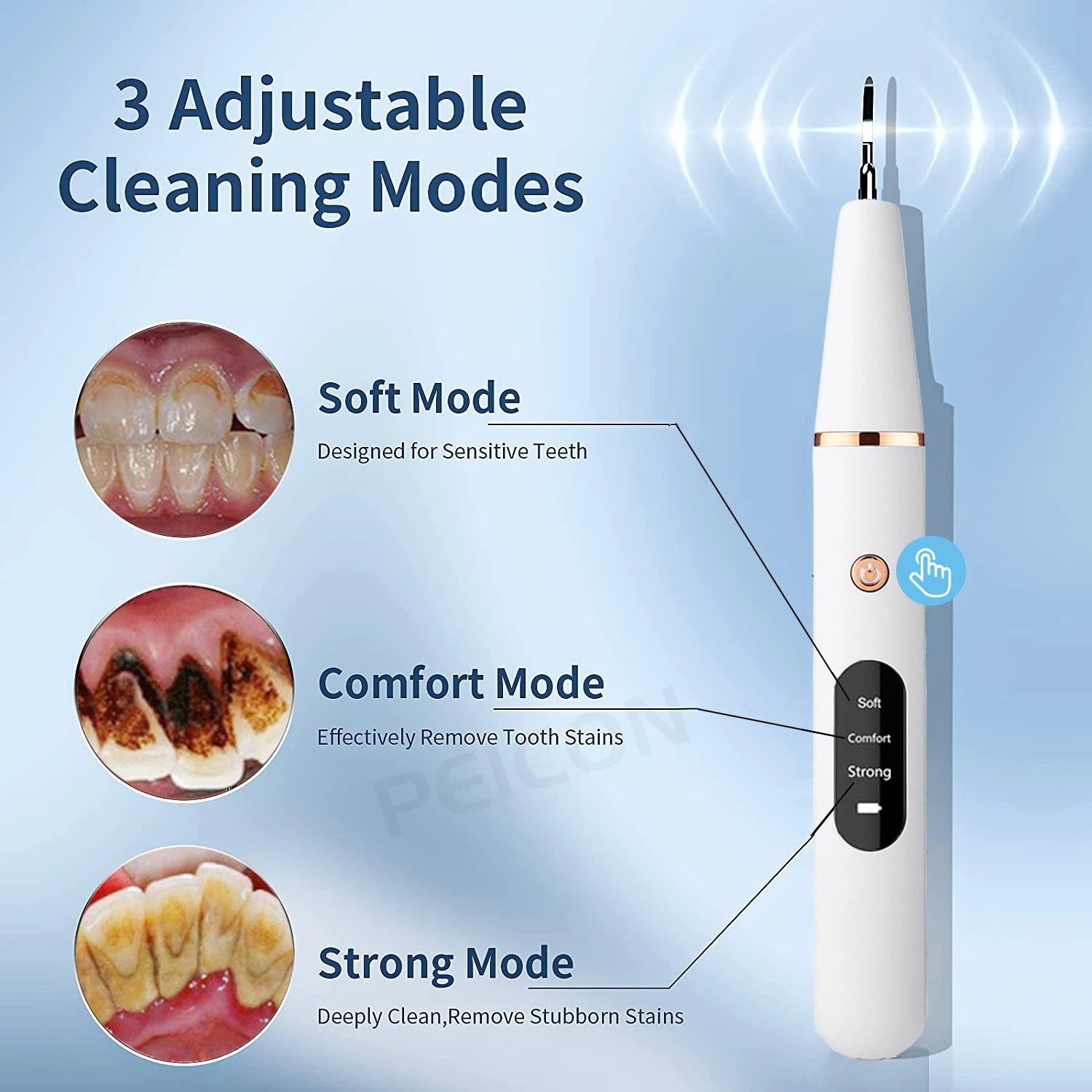 Nettoyeur et éliminateur de plaque dentaire à ultrasons Ultrasonic