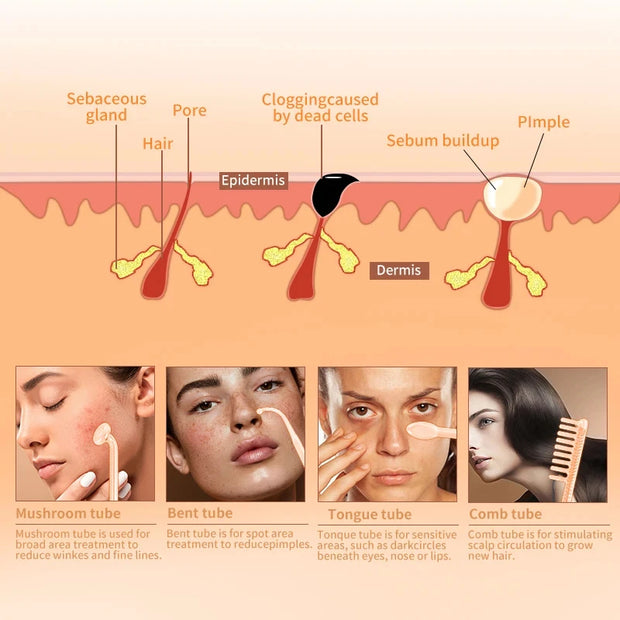 Baguette d'électrothérapie haute fréquence 4 en 1